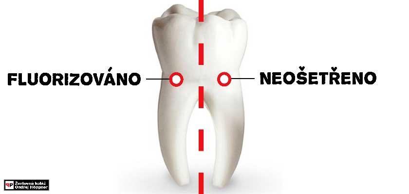 Zabijácká zubní pasta: máme se mít na pozoru před fluorem v našich ústech?