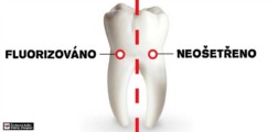 Zabijácká zubní pasta: máme se mít na pozoru před fluorem v našich ústech?